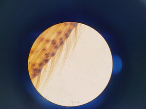 Thumbnail image of Kyowa Tokyo Compound Microscope with 4 x Objectives PL 20 Para Phase Lab