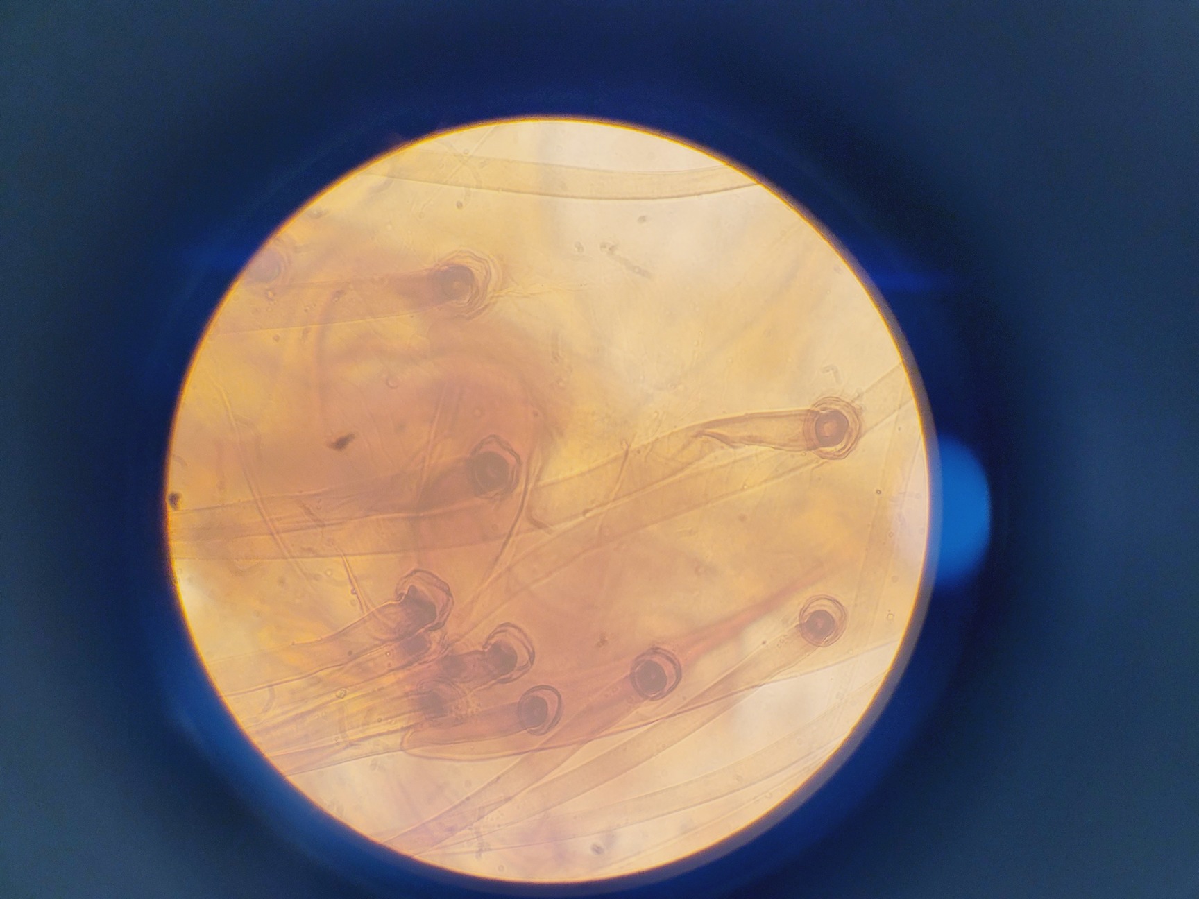 Image of Kyowa Tokyo Compound Microscope with 4 x Objectives PL 20 Para Phase Lab
