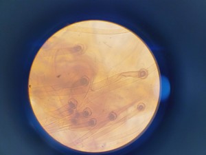 Thumbnail image of Kyowa Tokyo Compound Microscope with 4 x Objectives PL 20 Para Phase Lab