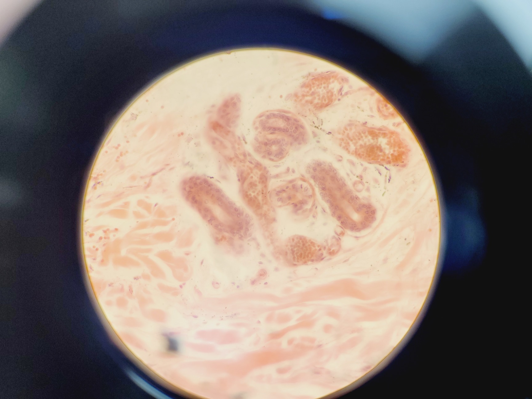 Image of Leica Model ATC 2000 Microscope w/ 4 x Achromatic Objectives Lab