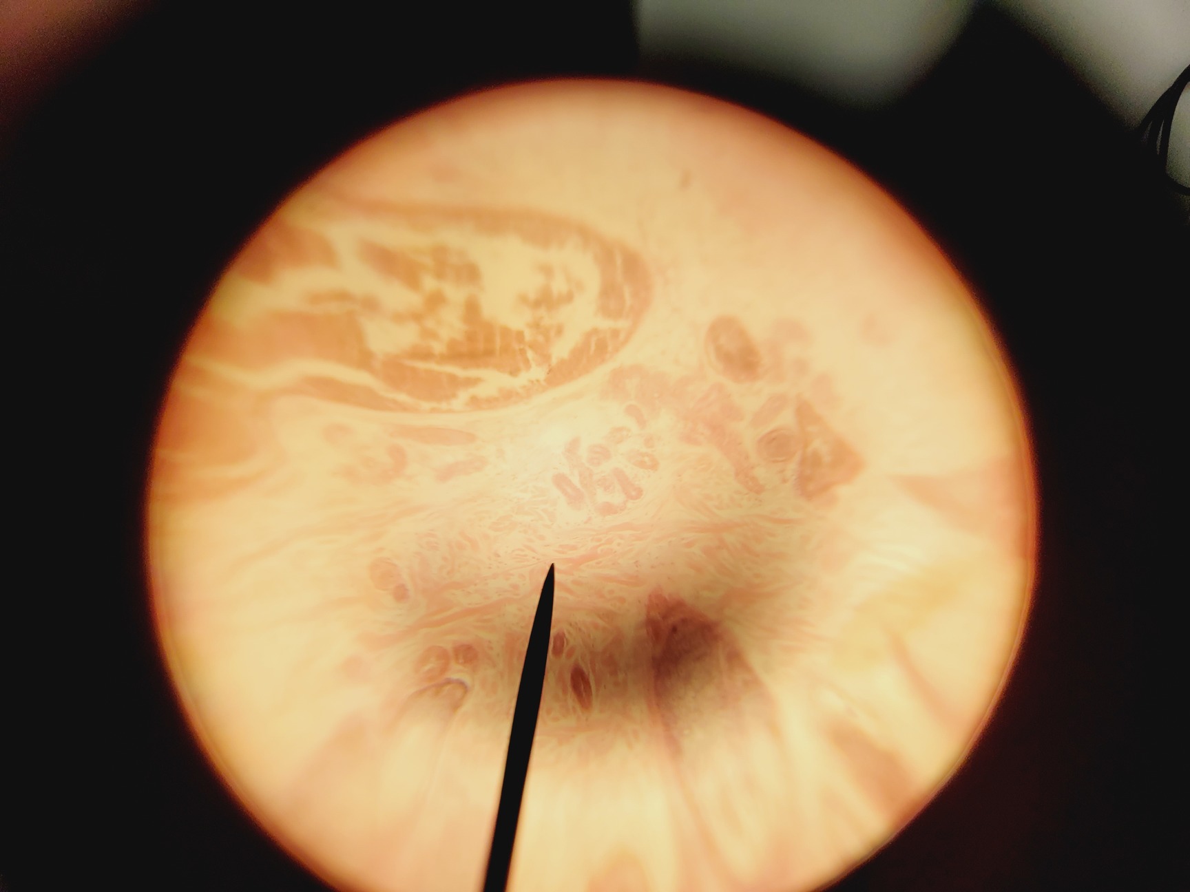 Image of Leica Model ATC 2000 Microscope w/ 4 x Achromatic Objectives Lab