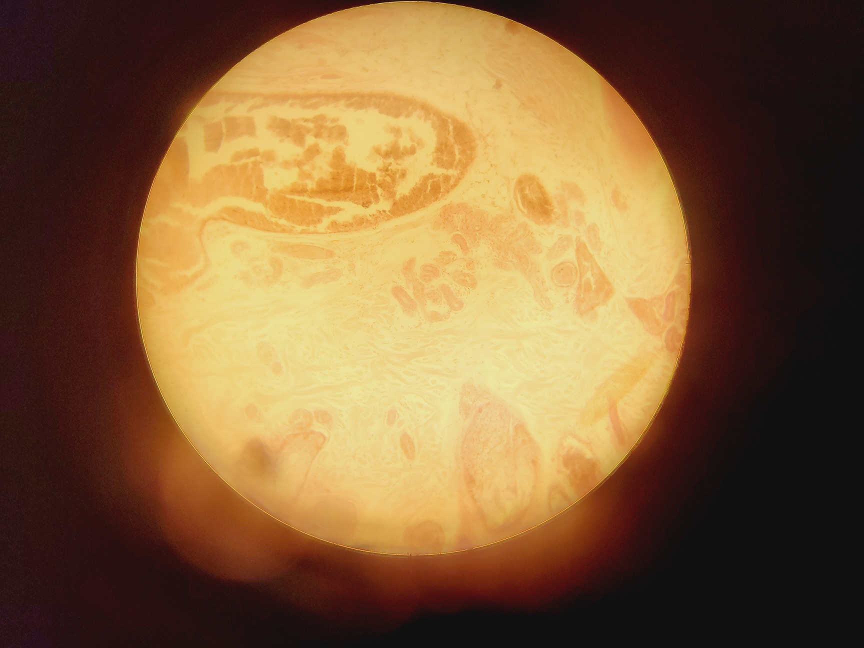 Image of Leica Model ATC 2000 Microscope w/ 4 x Achromatic Objectives Lab