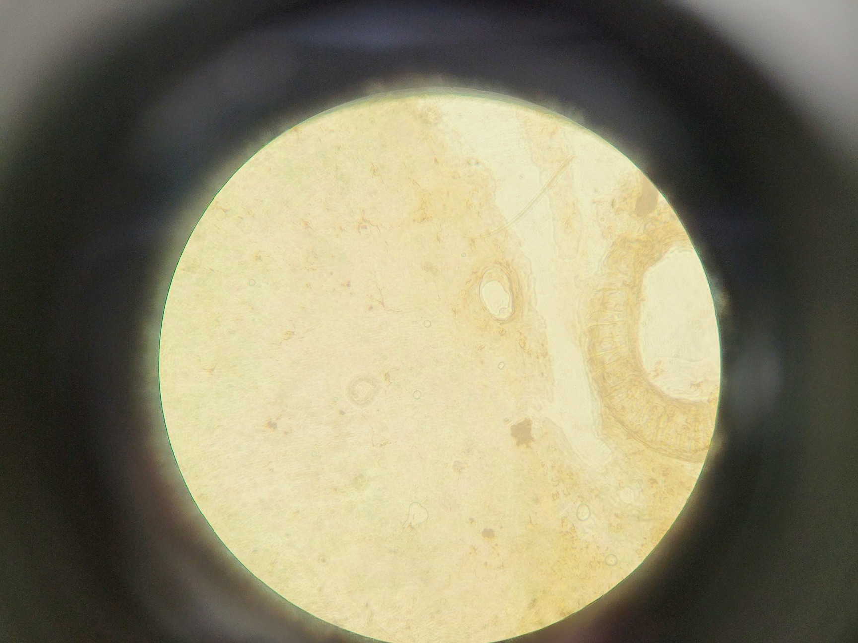 Image of HIPROVE XD-202 Inverted Biological Microscope w/ 4 x Objectives Lab