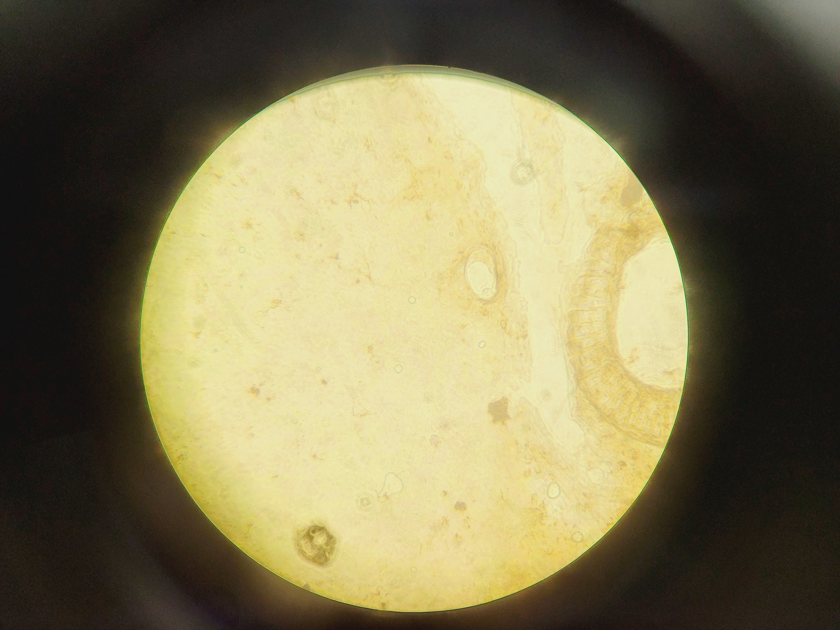 Image of HIPROVE XD-202 Inverted Biological Microscope w/ 4 x Objectives Lab