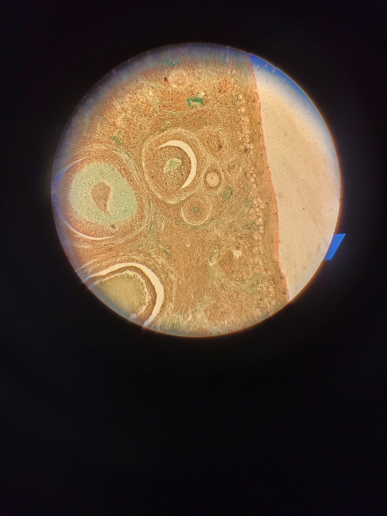 Image of Nikon Optiphot Microscope with 3 x Objectives - Ph 3 DL, Ph1, 4/0.1 160/- Lab