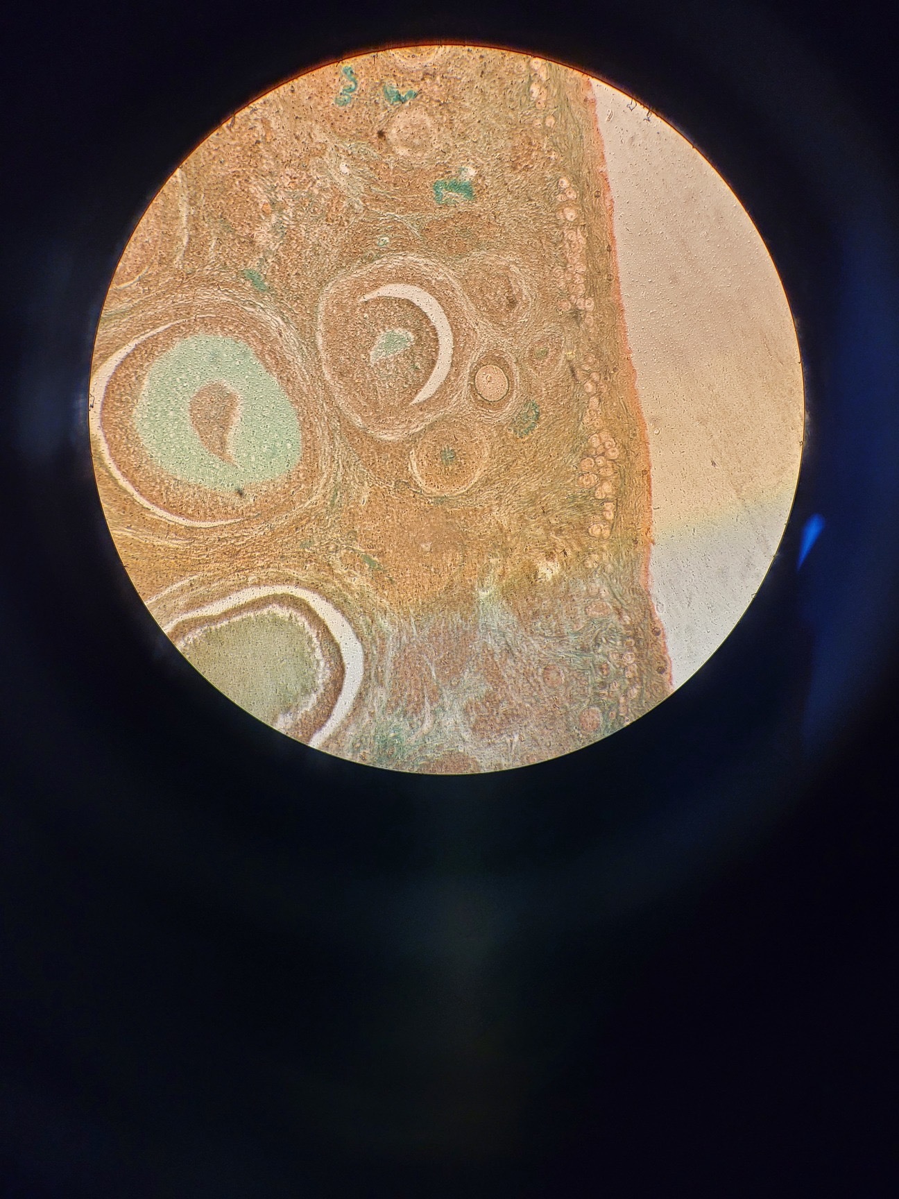 Image of Nikon Optiphot Microscope with 3 x Objectives - Ph 3 DL, Ph1, 4/0.1 160/- Lab