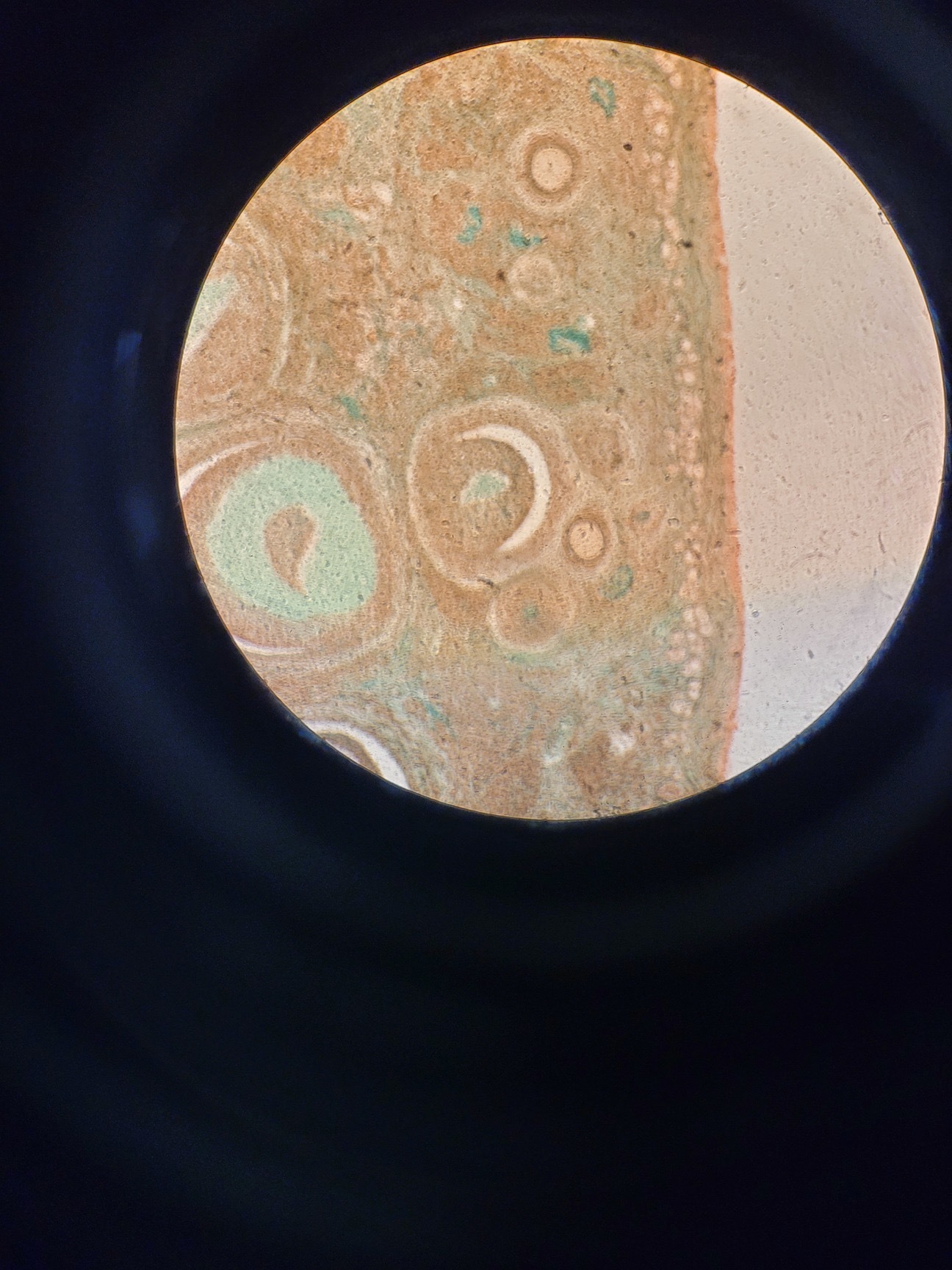 Image of Nikon Optiphot Microscope with 3 x Objectives - Ph 3 DL, Ph1, 4/0.1 160/- Lab