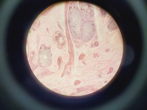 Thumbnail image of Nikon Optiphot Phase Contrast Microscope with 2 x Objectives - Ph1 DL Lab