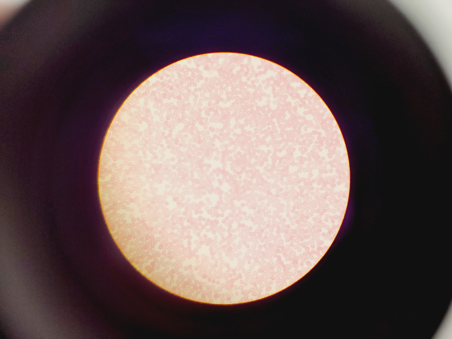 Image of Olympus CHT CH2 Binocular Microscope with 3 x E Objectives Lab