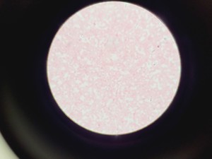 Thumbnail image of Olympus CH2 CHT Binocular Laboratory Microscope with 3 x Objectives Lab