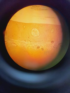 Thumbnail image of Olympus BX51WIF Fluorescence Microscope System with ThorLabs Optics Table Lab