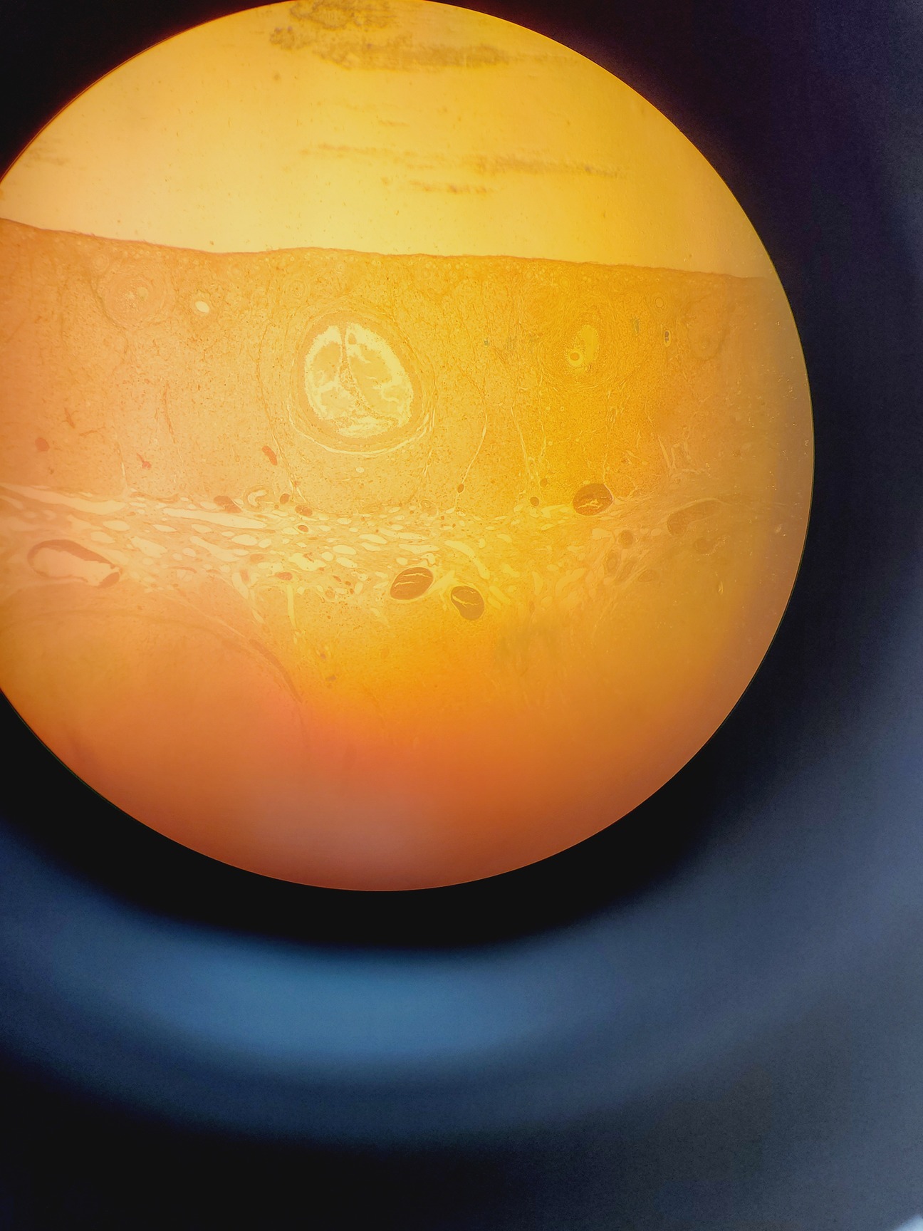 Image of Olympus BX51WIF Fluorescence Microscope System with ThorLabs Optics Table Lab