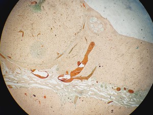 Thumbnail image of Kyowa Medilux-12 Binocular Microscope with 4 x Objectives Lab