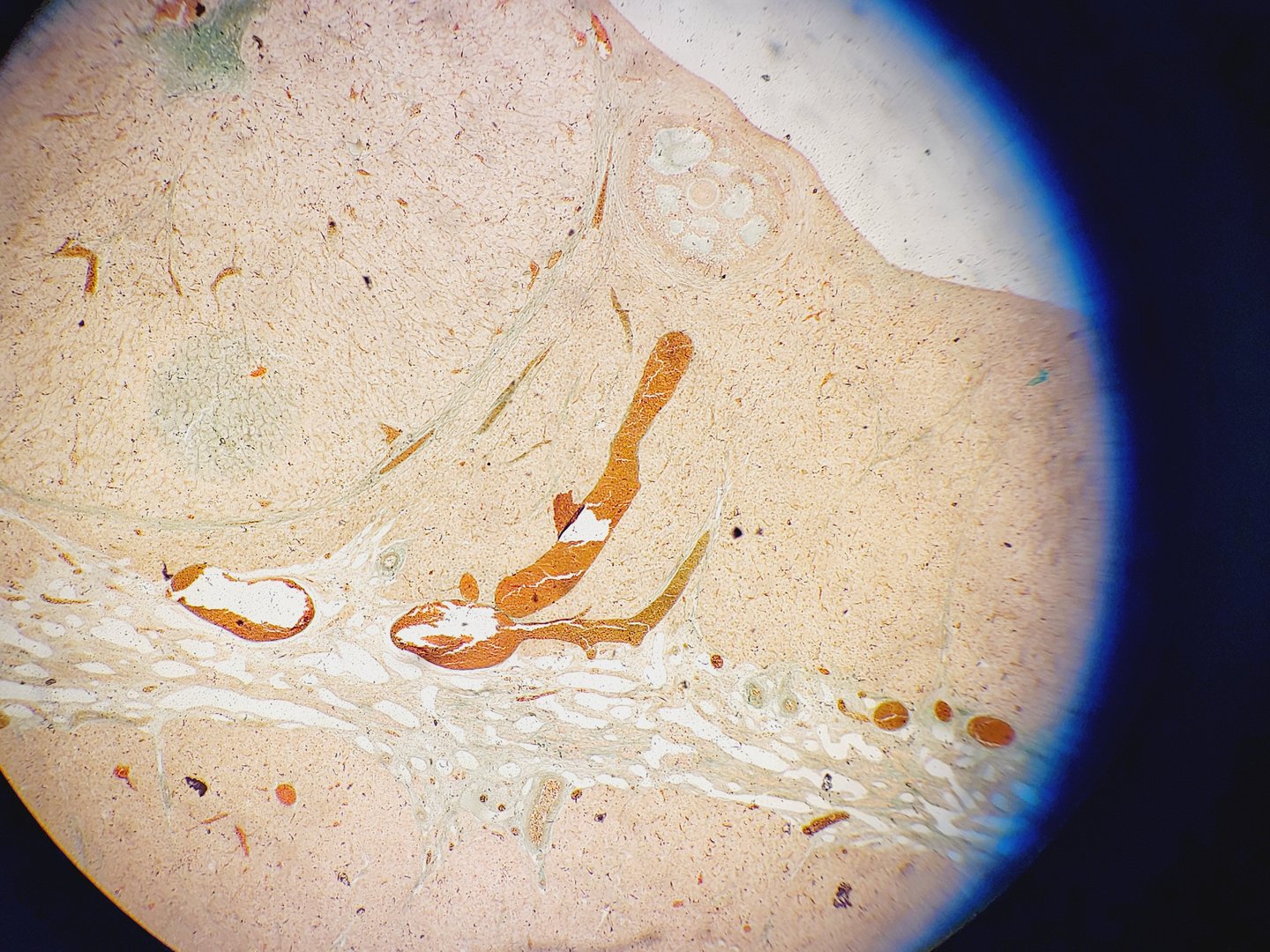 Image of Kyowa Medilux-12 Binocular Microscope with 4 x Objectives Lab