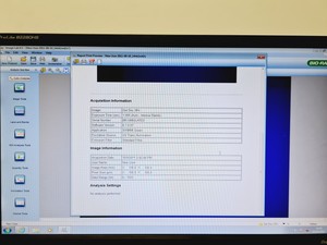 Thumbnail image of Bio-Rad Molecular Imaging Gel Doc XR+ Universal Hood II System Lab