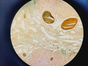 Thumbnail image of Olympus Vanox-T AH2 Research Photomicrographic Microscope & 6 x Objectives Lab