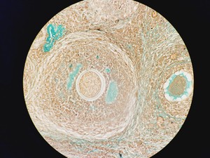 Thumbnail image of Leica DM5500B Fluorescence Motorised Microscope w/CTR6000 & EL6000
