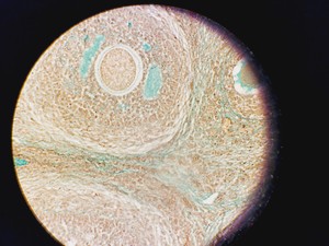 Thumbnail image of Leica DM5500B Fluorescence Motorised Microscope w/CTR6000 & EL6000