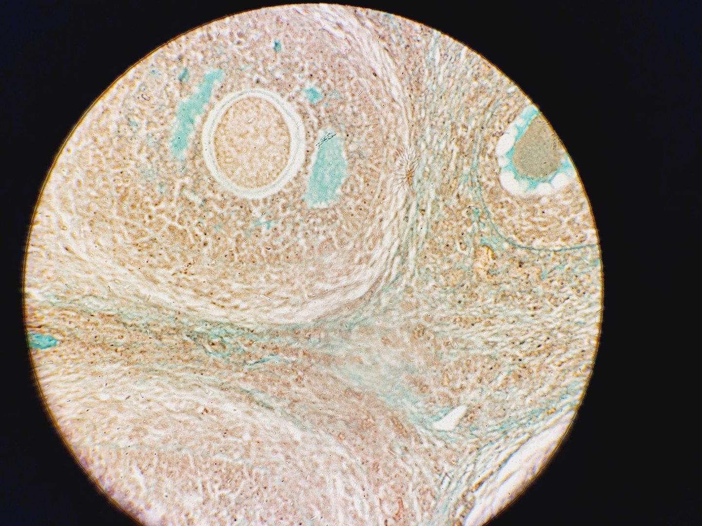 Image of Leica DM5500B Fluorescence Motorised Microscope w/CTR6000 & EL6000