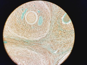 Thumbnail image of Leica DM5500B Fluorescence Motorised Microscope w/CTR6000 & EL6000