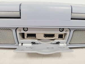 Thumbnail image of Zoneare Z.One Ultra SmartCart and Scan Engine Ultrasound System