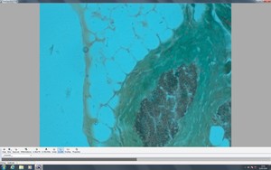 Thumbnail image of Zeiss Observer.Z1 Inverted Fluorescence Motorised Microscope