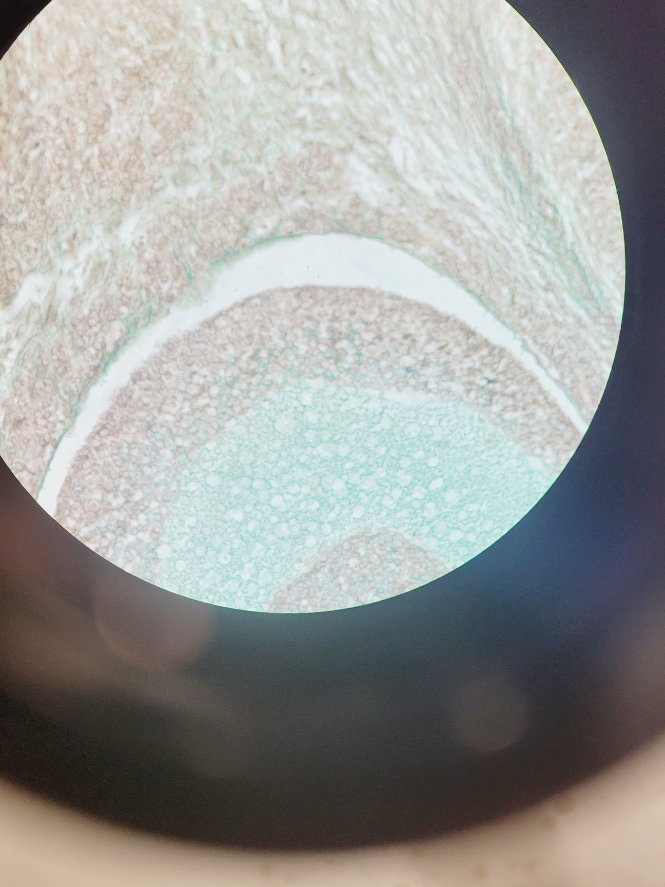 Image of Zeiss Observer.Z1 Inverted Fluorescence Motorised Microscope