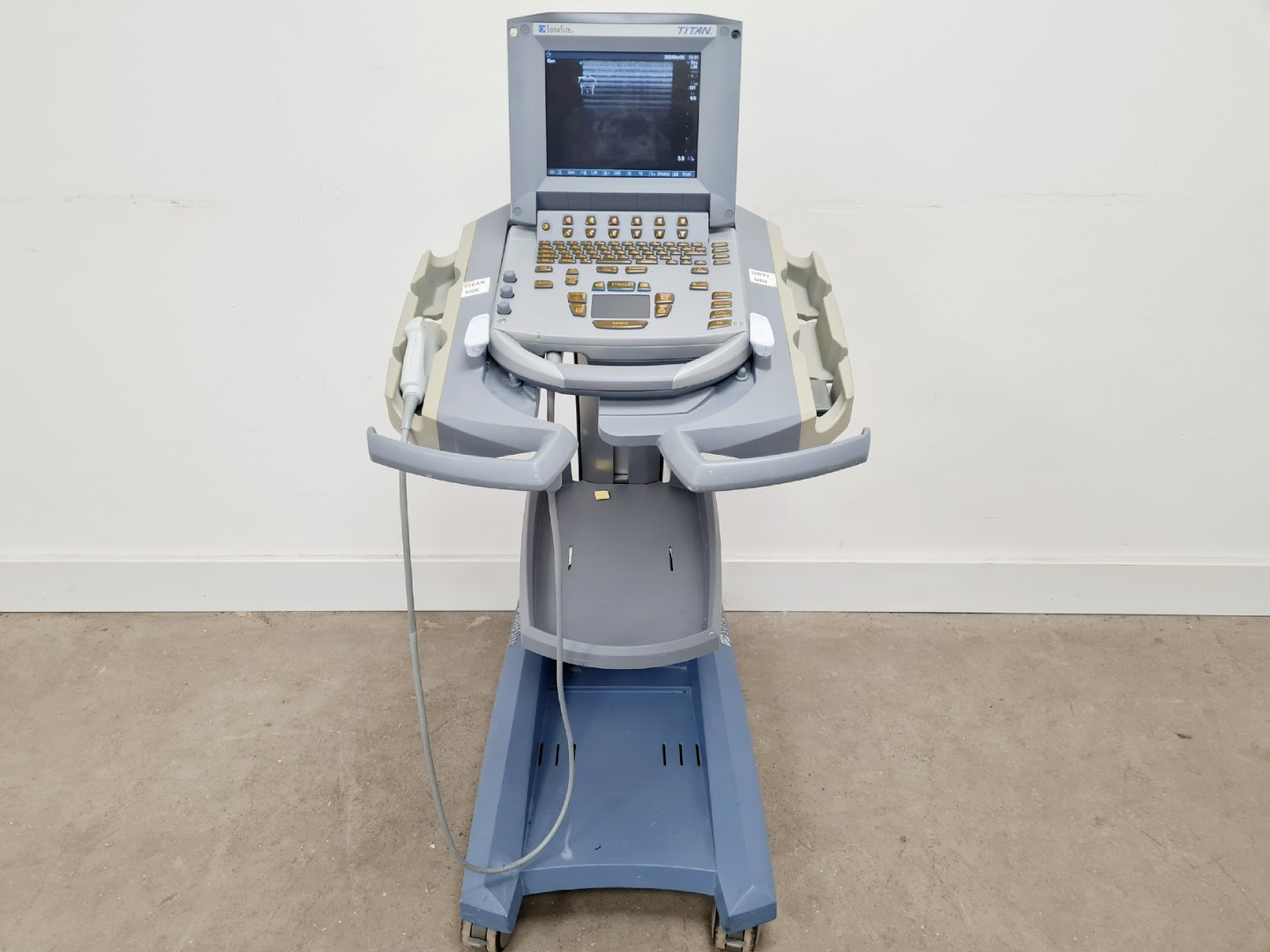 Image of SonoSite Titan Portable Ultrasound Machine