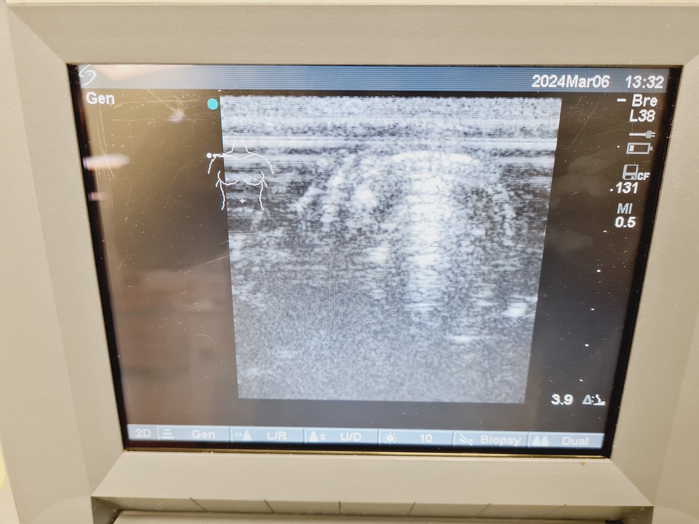 Image of SonoSite Titan Portable Ultrasound Machine