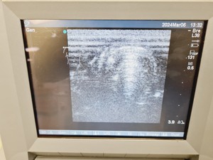 Thumbnail image of SonoSite Titan Portable Ultrasound Machine