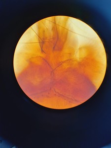 Thumbnail image of Olympus BH-2 Compound Microscope with 4 x Objectives Lab