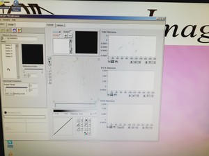 Thumbnail image of Topcon TRC-50DX Optical Ophthalmic Imaging System