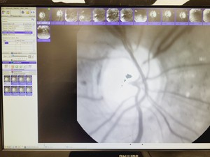 Thumbnail image of Topcon TRC-50DX Optical Ophthalmic Imaging System