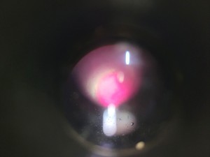 Thumbnail image of Nikon SBR-KT Microscope  with 4 x Objectives Lab
