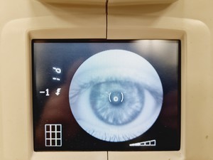 Thumbnail image of Topcon TRC NW6S Non-Mydriatic w/ Nikon D200 Lab