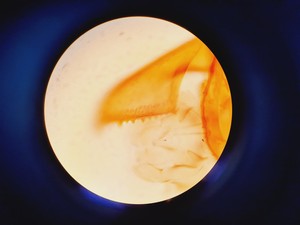 Thumbnail image of Leica DMLS Clinical Microscope w/ 3 Objectives 40x/0.65, 20x/0.40, 10x/0.22