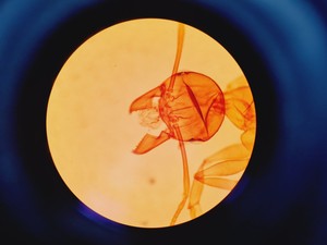 Thumbnail image of Leica DMLS Clinical Microscope w/ 3 Objectives 40x/0.65, 20x/0.40, 10x/0.22