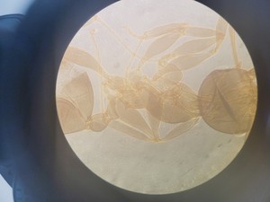 Thumbnail image of Nikon Eclipse TS100 Microscope w/ 3 x Objectives Ph1, 10x, 20x, 40x Lab
