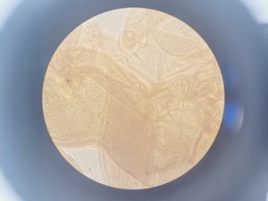Thumbnail image of Nikon Eclipse TS100 Microscope w/ 3 x Objectives Ph1, 10x, 20x, 40x Lab