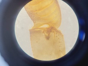 Thumbnail image of Nikon Eclipse TS100 Microscope w/ 3 x Objectives Ph1, 10x, 20x, 40x Lab