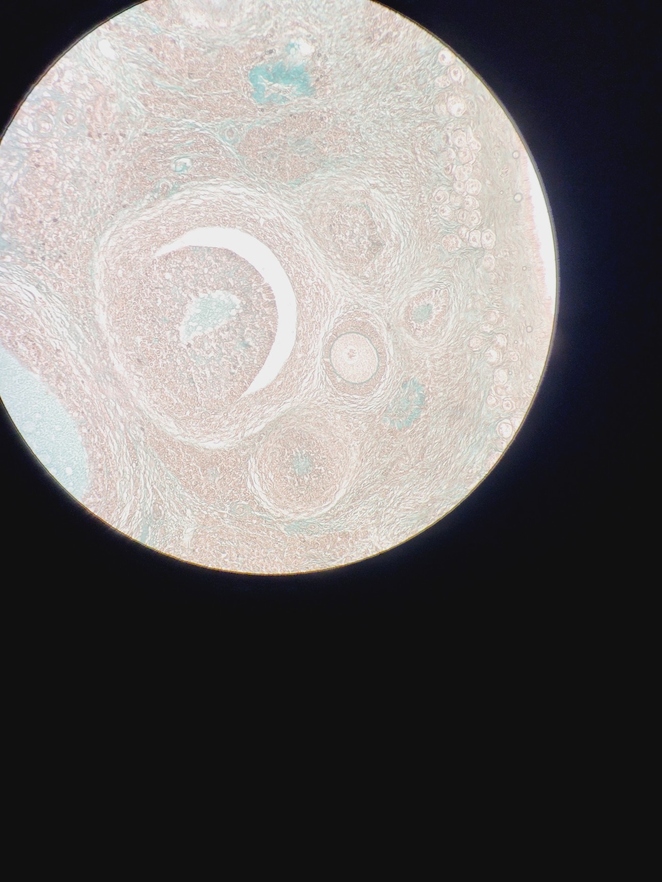 Image of Zeiss Axioskop Microscope w/ 3 x Objectives NEOFL 100x, 40x, 20x Lab