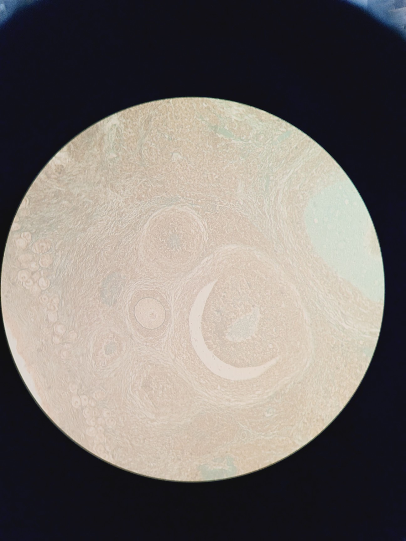 Image of Nikon Eclipse TE200 Microscope w/ 3 x Objectives Plan, Ph w/  TE-PS100 PSU Lab