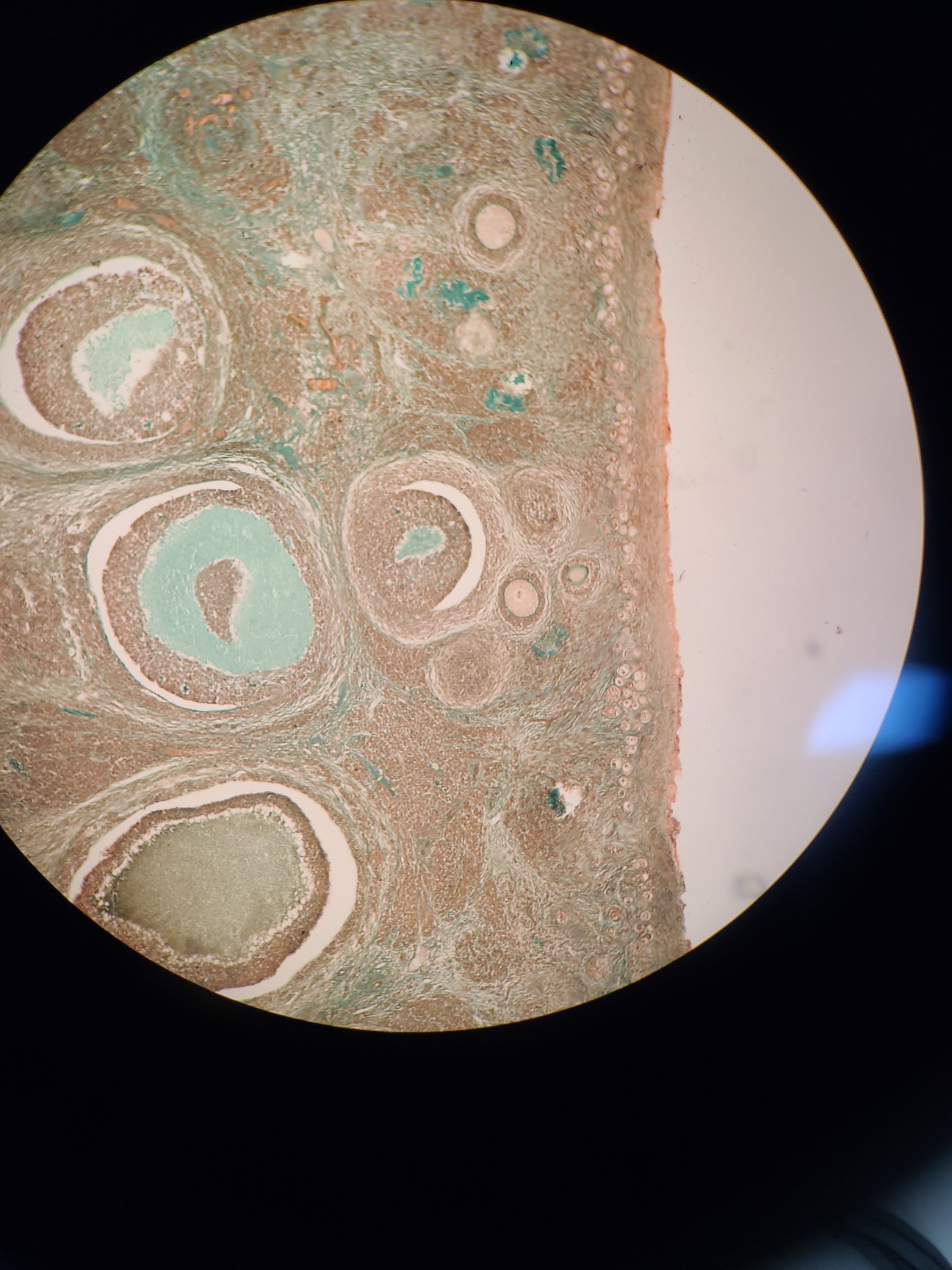 Image of Nikon Eclipse E800 Microscope w/ Plan Flour 10x/0.30 Objective Lab