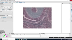 Thumbnail image of Nikon Eclipse NI-U Microscope System with Infinity 3 Camera Lab