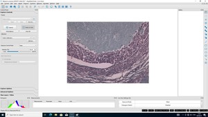 Thumbnail image of Nikon Eclipse NI-U Microscope System with Infinity 3 Camera Lab