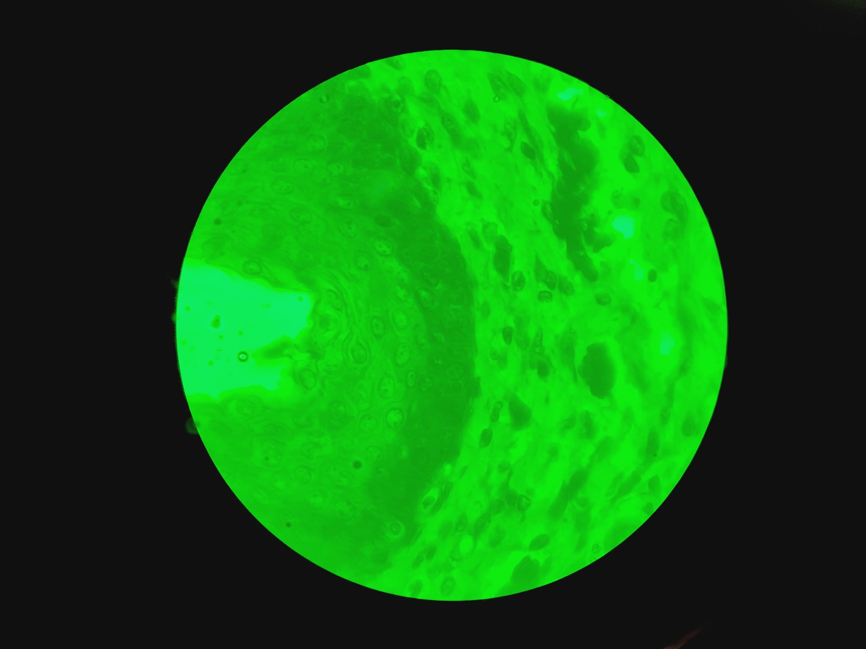 Image of Motic BA310E Fluorescence Microscope w/ 4 x Objectives Motic 100X/1.25 oil Lab 