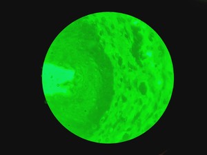 Thumbnail image of Motic BA310E Fluorescence Microscope w/ 4 x Objectives Motic 100X/1.25 oil Lab 
