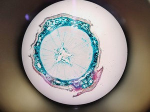 Thumbnail image of Leica DM LB2 Biological Microscope w/ 5 x Objectives N Plan 2.5x 5x 10x 20x Lab
