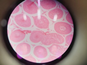 Thumbnail image of Leica DM LB2 Biological Microscope w/ 5 x Objectives N Plan 2.5x 5x 10x 20x Lab