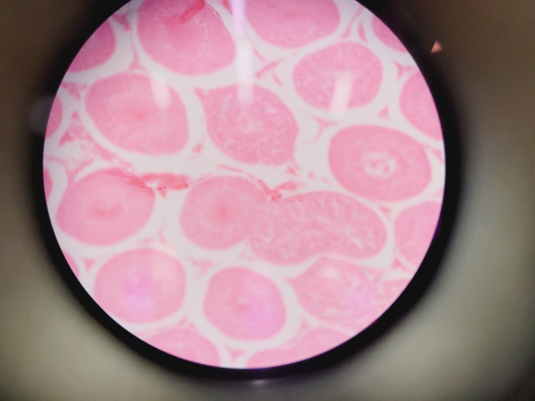 Image of Leica DM LB2 Biological Microscope w/ 5 x Objectives N Plan 2.5x 5x 10x 20x Lab